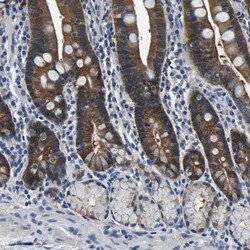 Aconitase 1 Antibody, Novus Biologicals 0.1mL; Unlabeled:Antibodies, Polyclonal